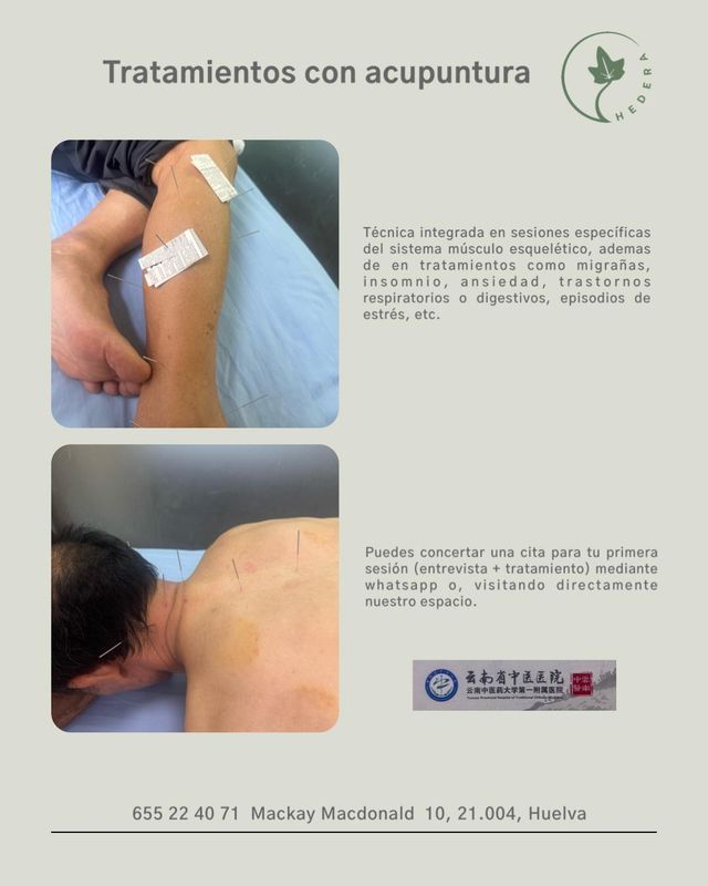 Acercar imagen: Hedera