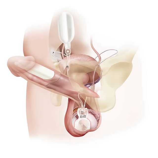 Powiększ obraz: MENVITA - Klinika Andrologii i Zdrowia Seksualnego
