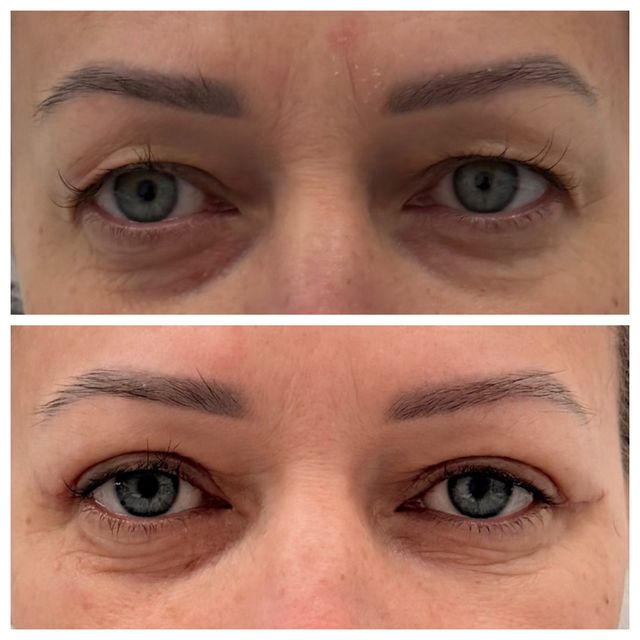 Powiększ obraz: VITALIFE