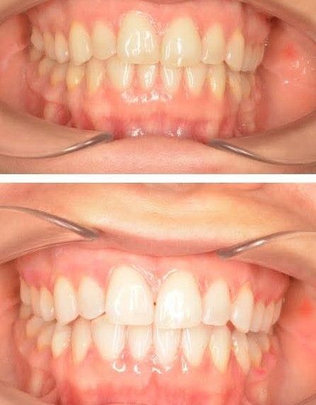 Powiększ obraz: Stomatologia Kalukin - Endodoncja i Implantologia