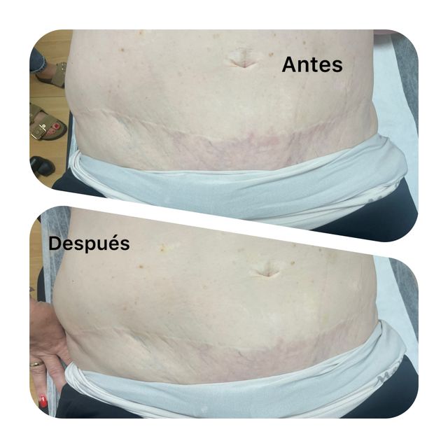 Acercar imagen: Consulta online