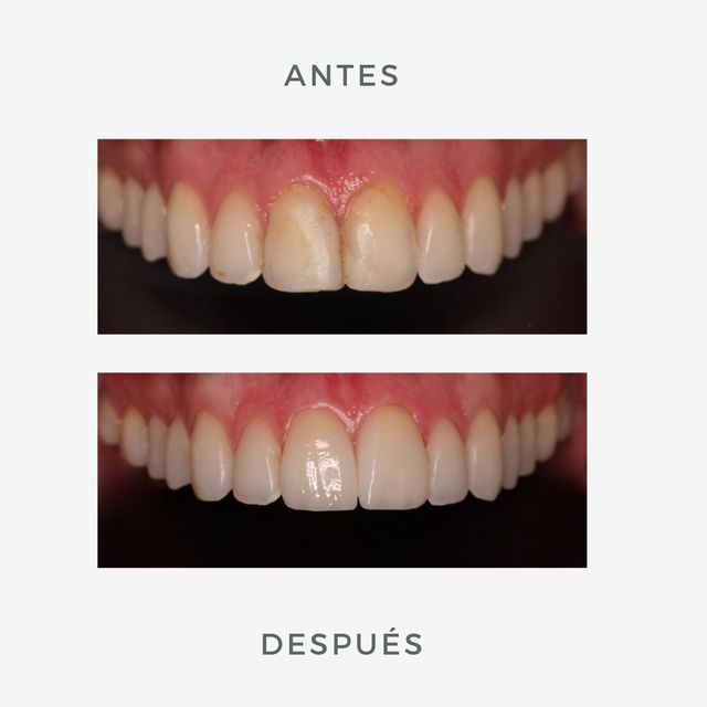 Acercar imagen: Marien Morata Roig Odontología Estética Online
