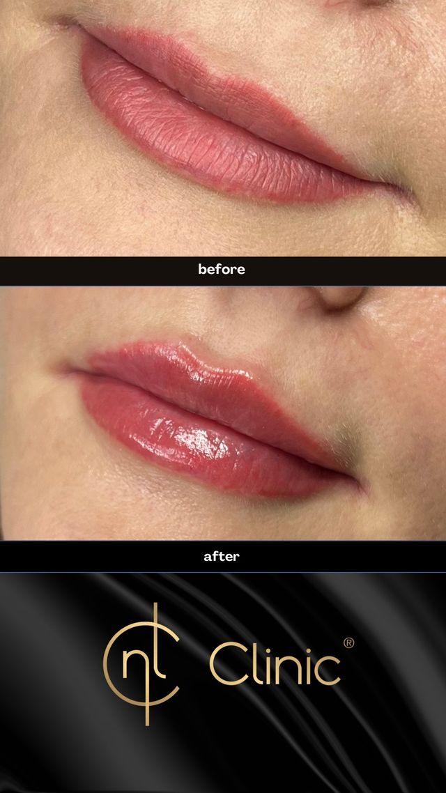 Powiększ obraz: Medycyna Estetyczna NL Clinic