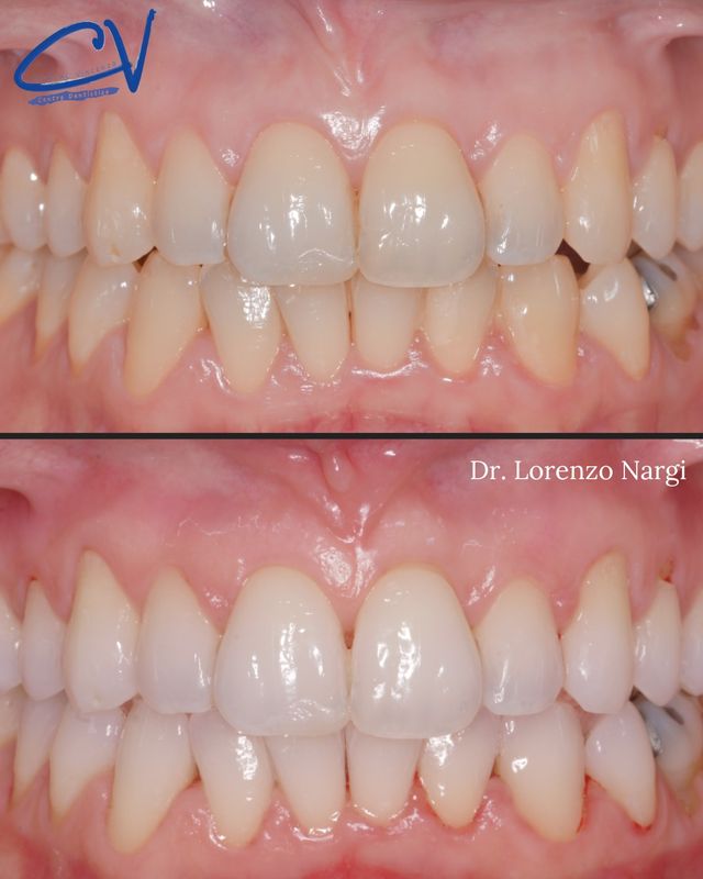 Ingrandire l'immagine: CENTRO ODONTOIATRICO DR. CARBONE VINCENZO SRL