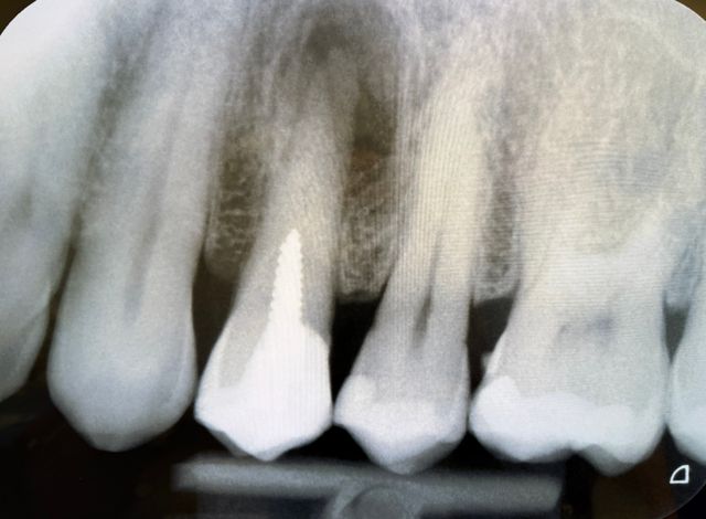 Ingrandire l'immagine: Consulenza Online