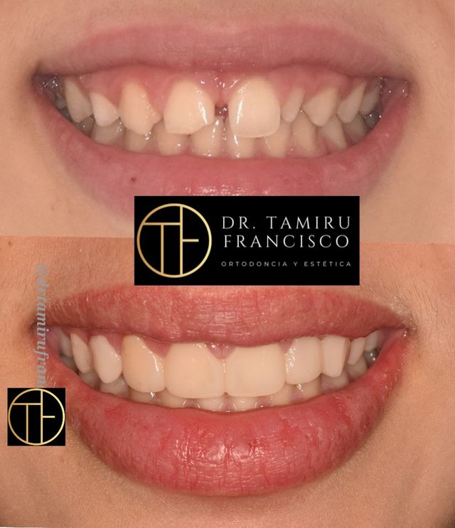 Acercar imagen: Consulta online. Dr. Tamiru Francisco Aduna ORTODONCIA