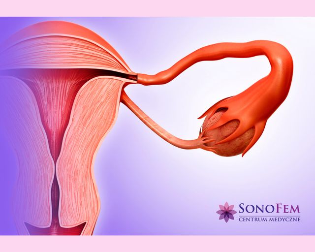 Powiększ obraz: SonoFem Centrum Medyczne