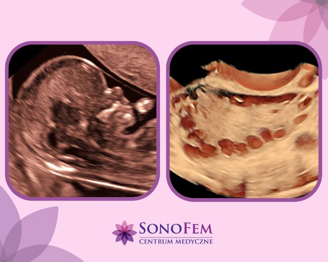 Powiększ obraz: SonoFem Centrum Medyczne