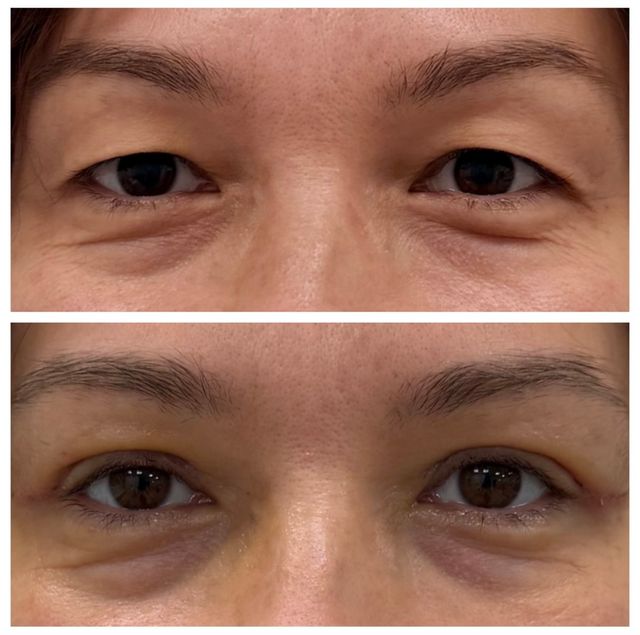 Powiększ obraz: VITALIFE