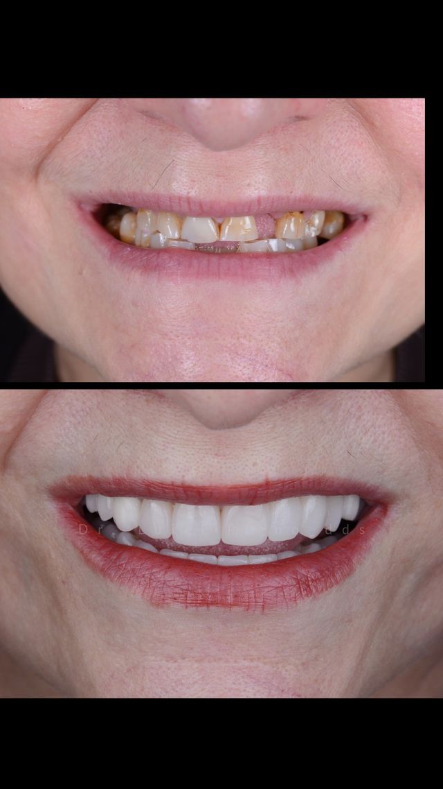 Ingrandire l'immagine: Studio Dentistico Pigno - Dr. Luigi Pigno