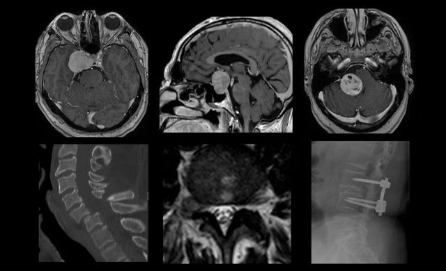 Ingrandire l'immagine: NEUROMED Ospedale IRCCS Neuromed