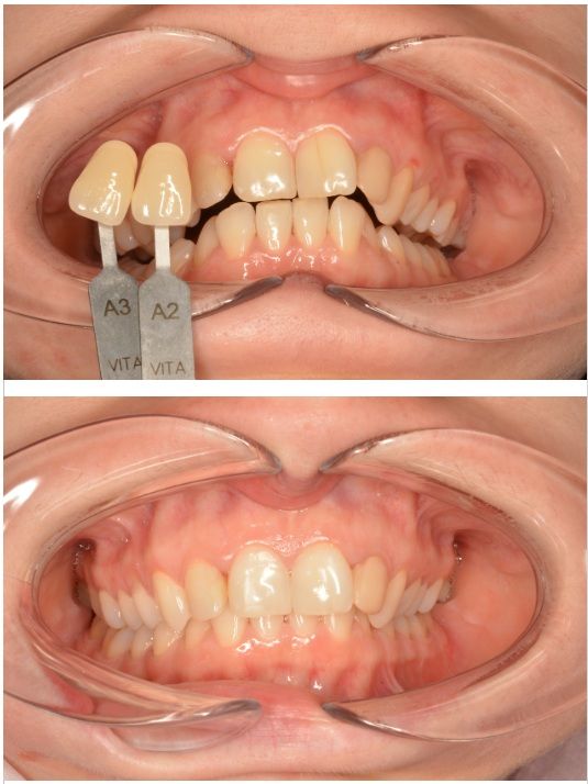 Powiększ obraz: Stomatologia Kalukin - Endodoncja i Implantologia