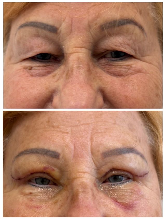 Powiększ obraz: OPTÉA FACE LAB