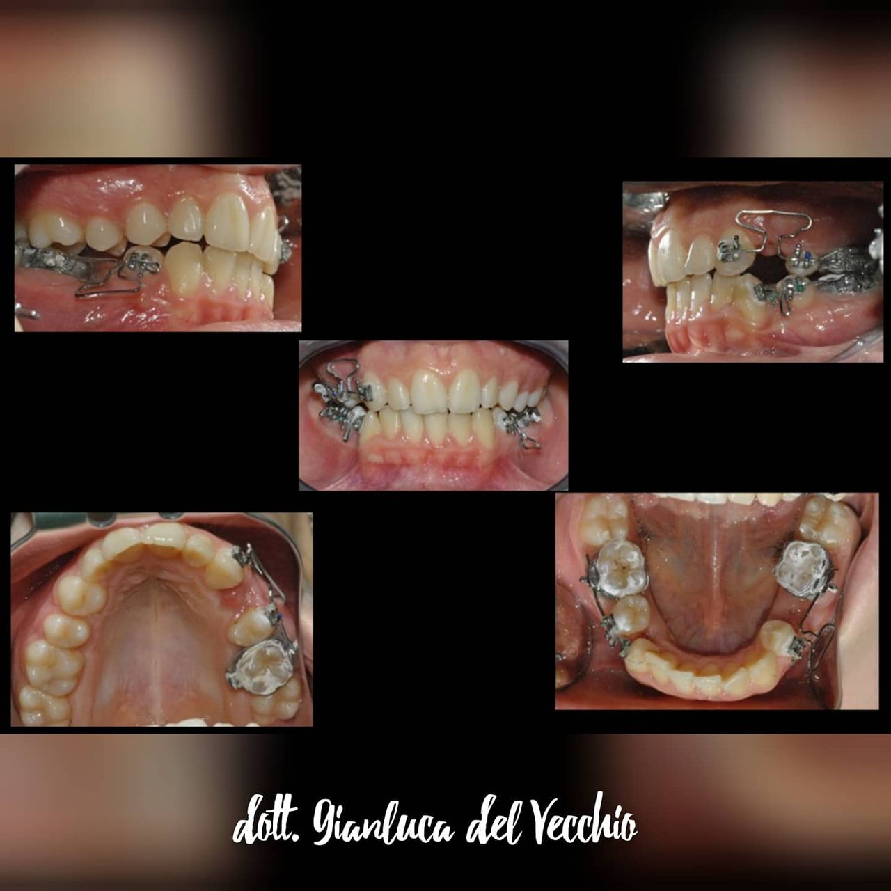 Gianluca Del Vecchio-86