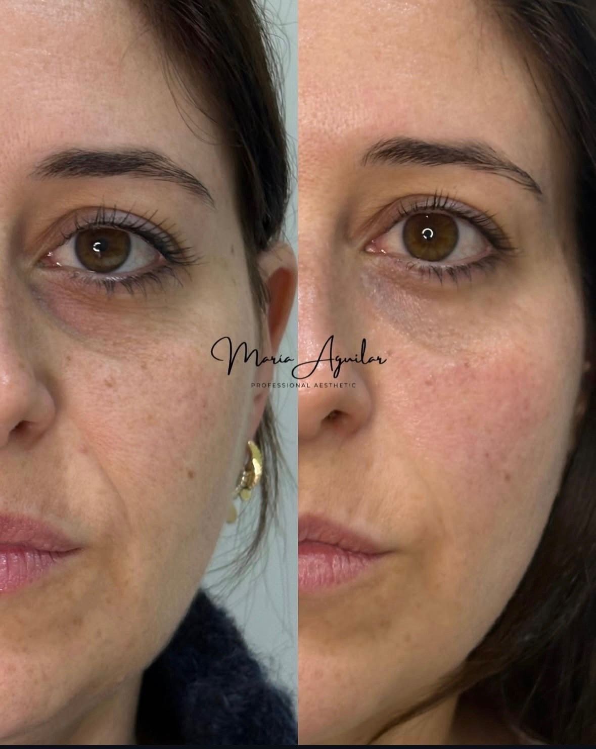 María Aguilar Pozo-18