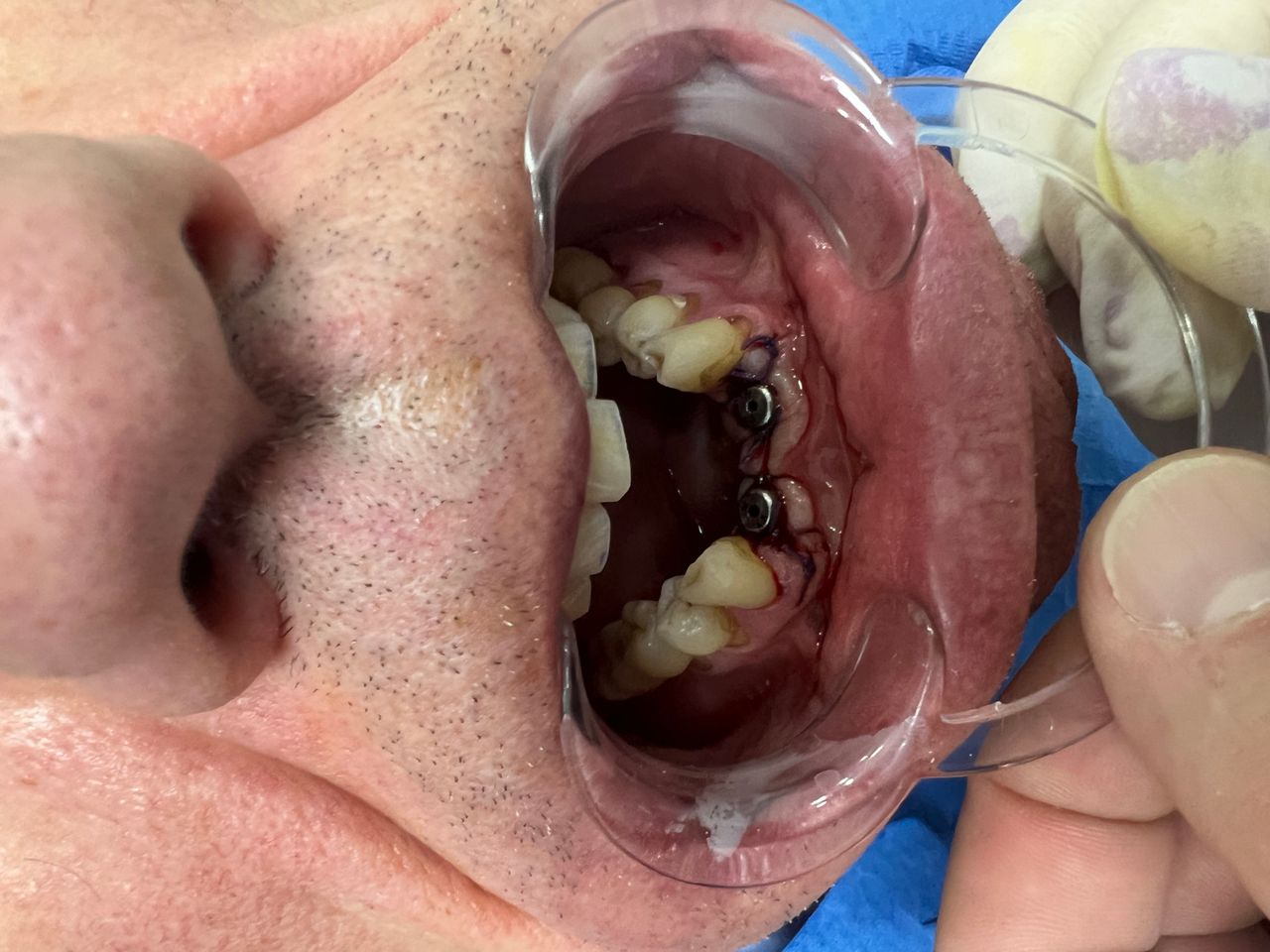 Luigi Aiardo Esposito-11