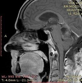 Jarosław Andrychowski-51