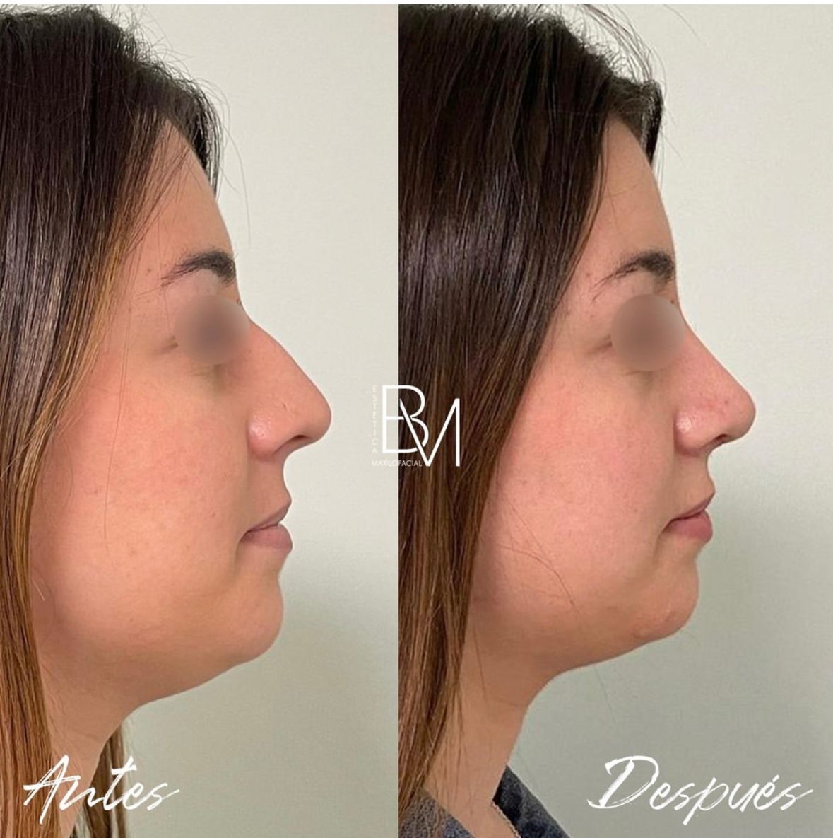 Beatriz Moralejo-46