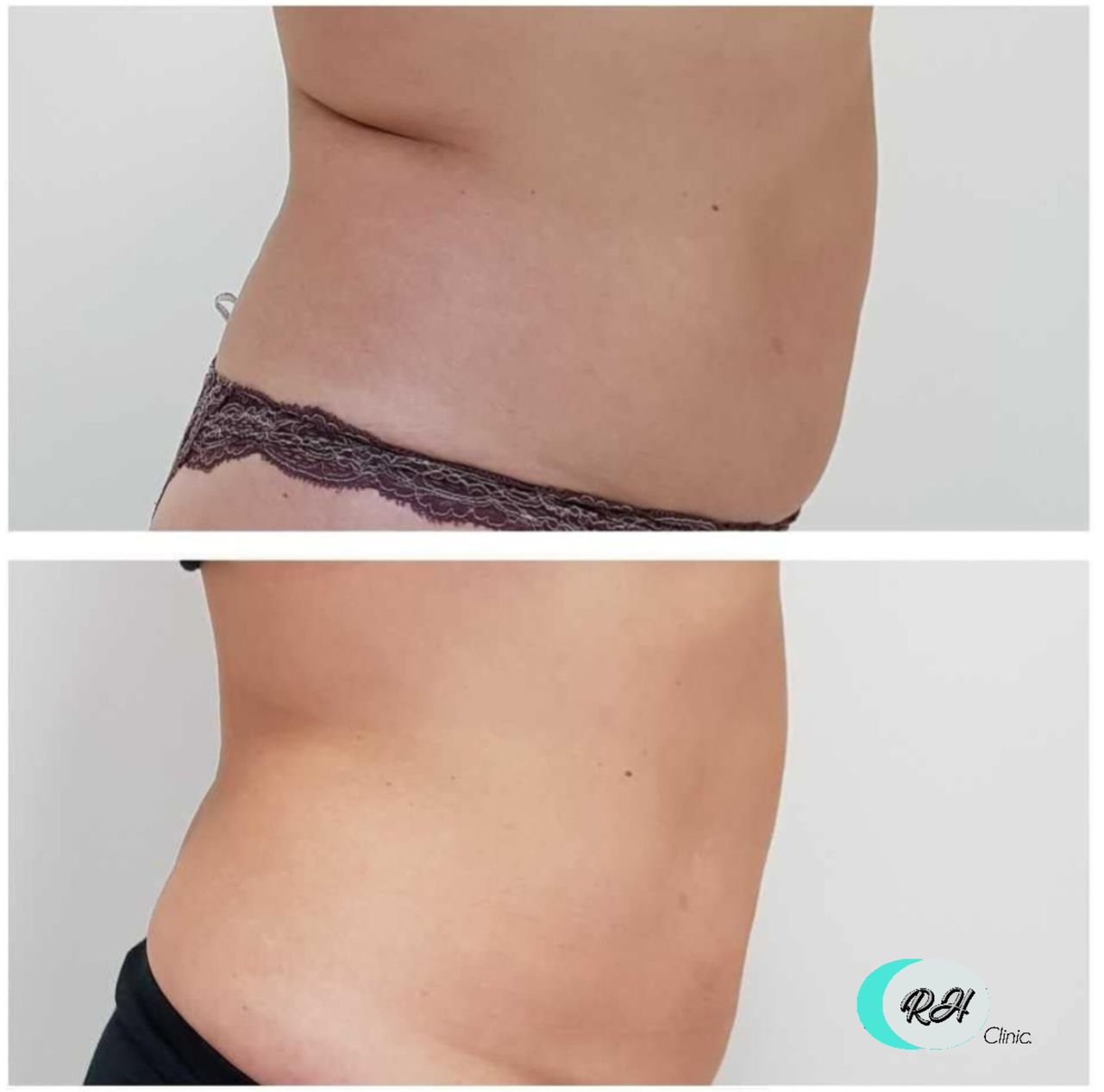 Rosalba Herrero Zerpa-618