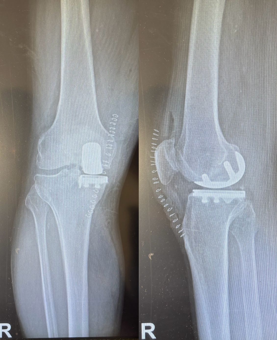 Alessandro Del Monaco-2