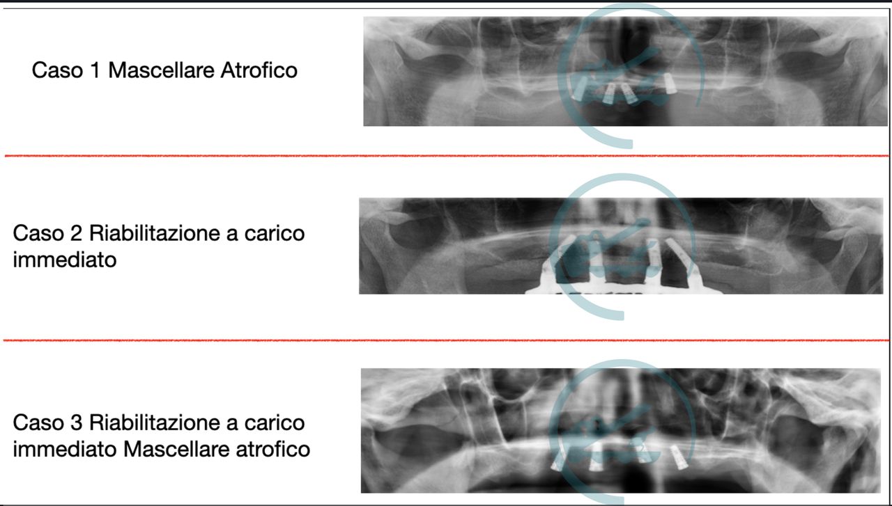 Raffaele D'ambrosio-0