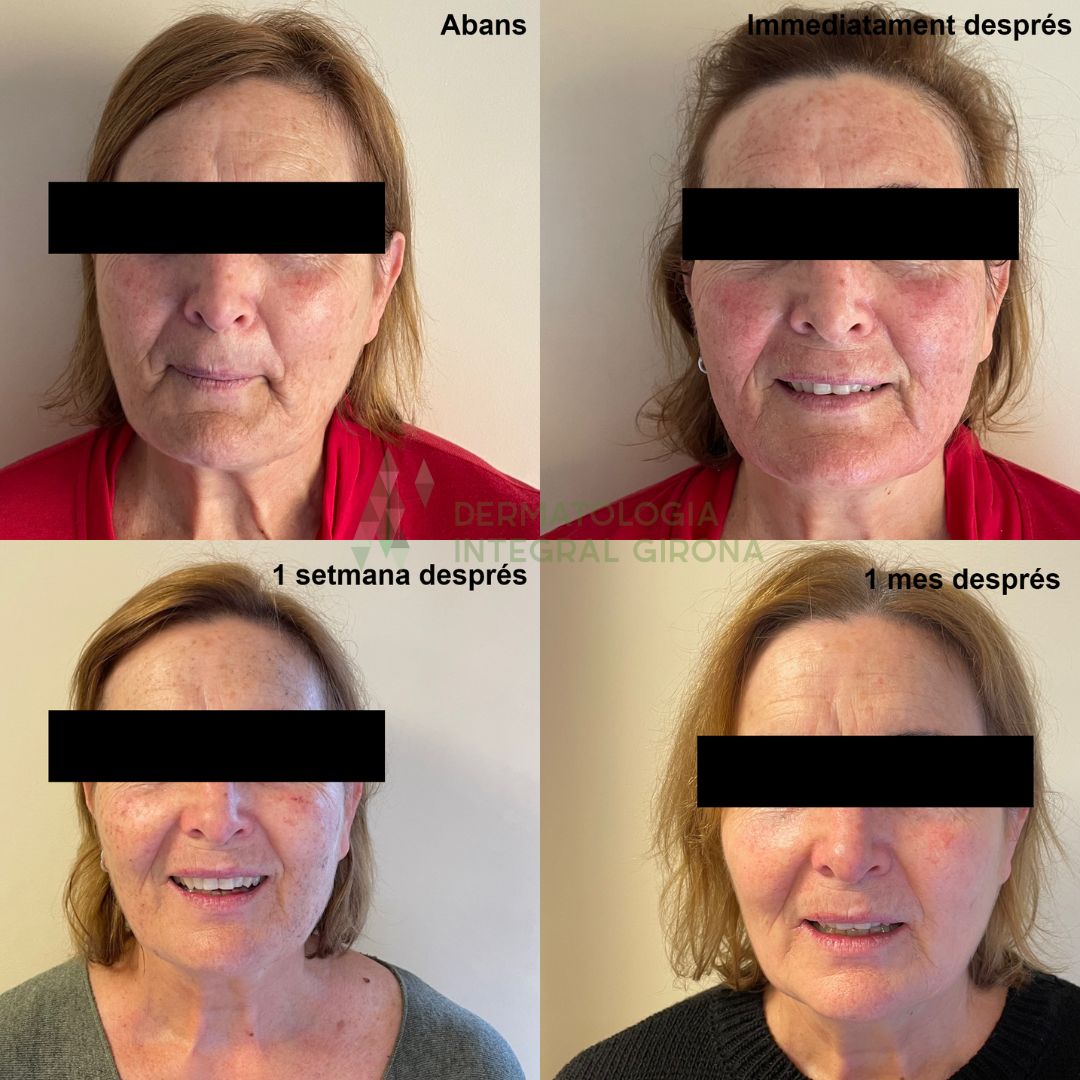 Maria Damont Serra-0