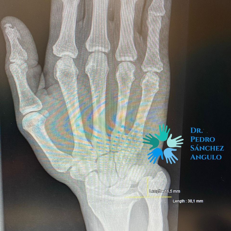 Pedro Sánchez Angulo-11