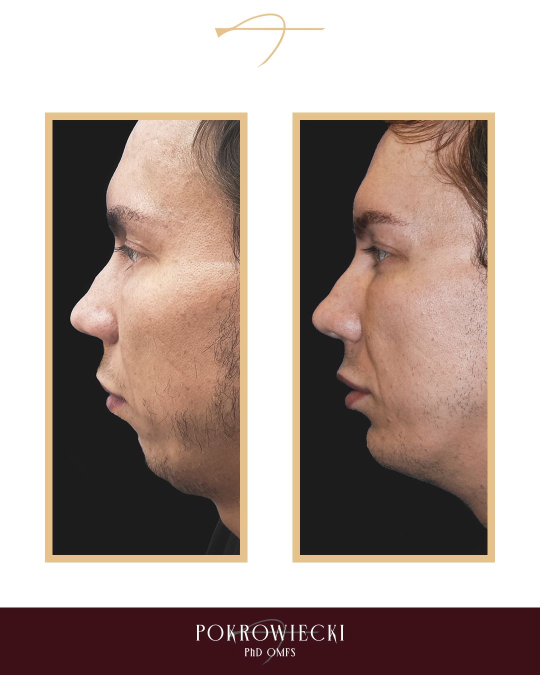 Rafał Pokrowiecki-22