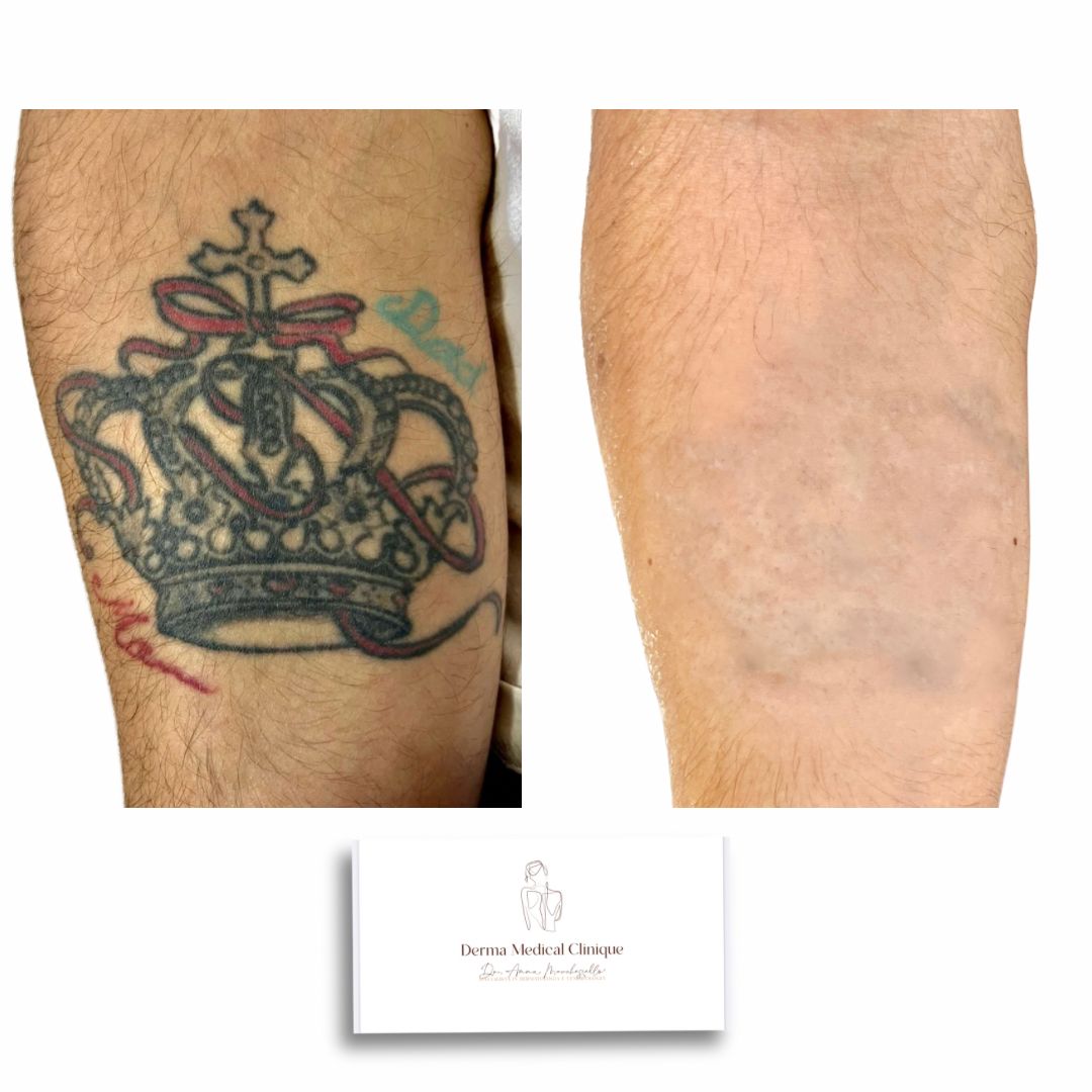 Anna Marchesiello-16