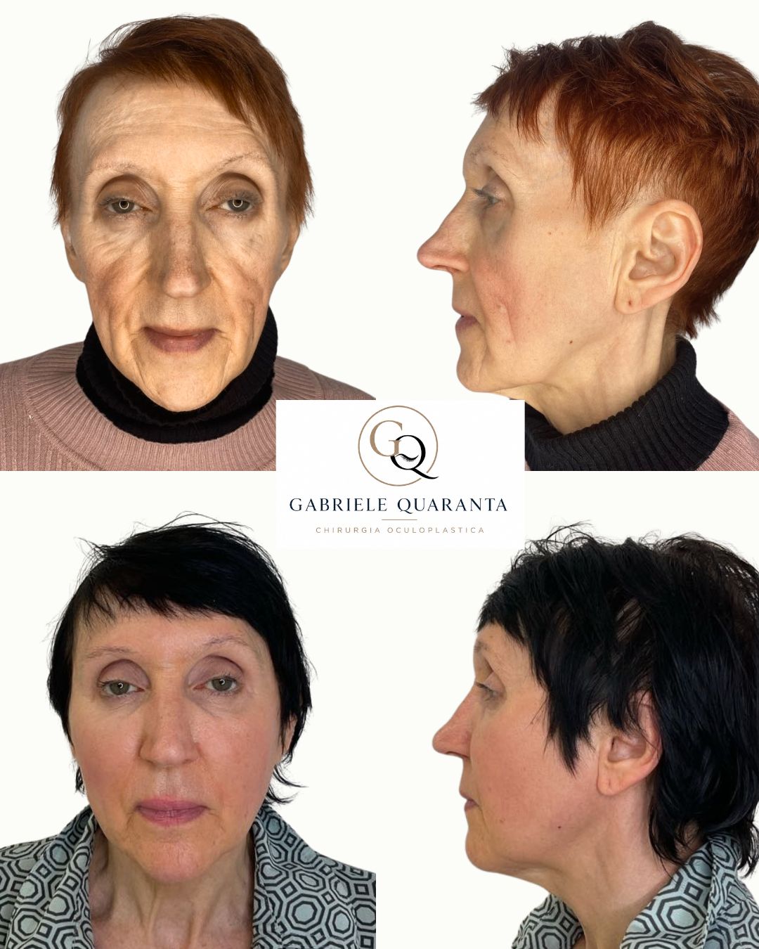 Gabriele Quaranta-0