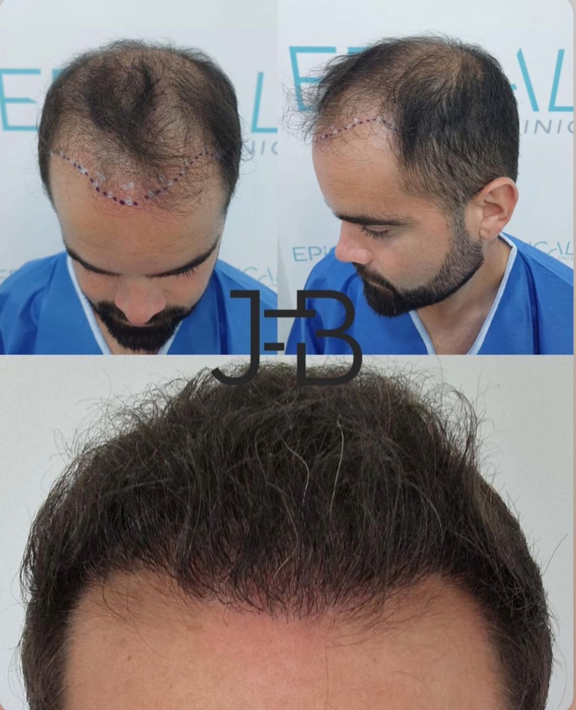 Juan Francisco Belén Montero-14