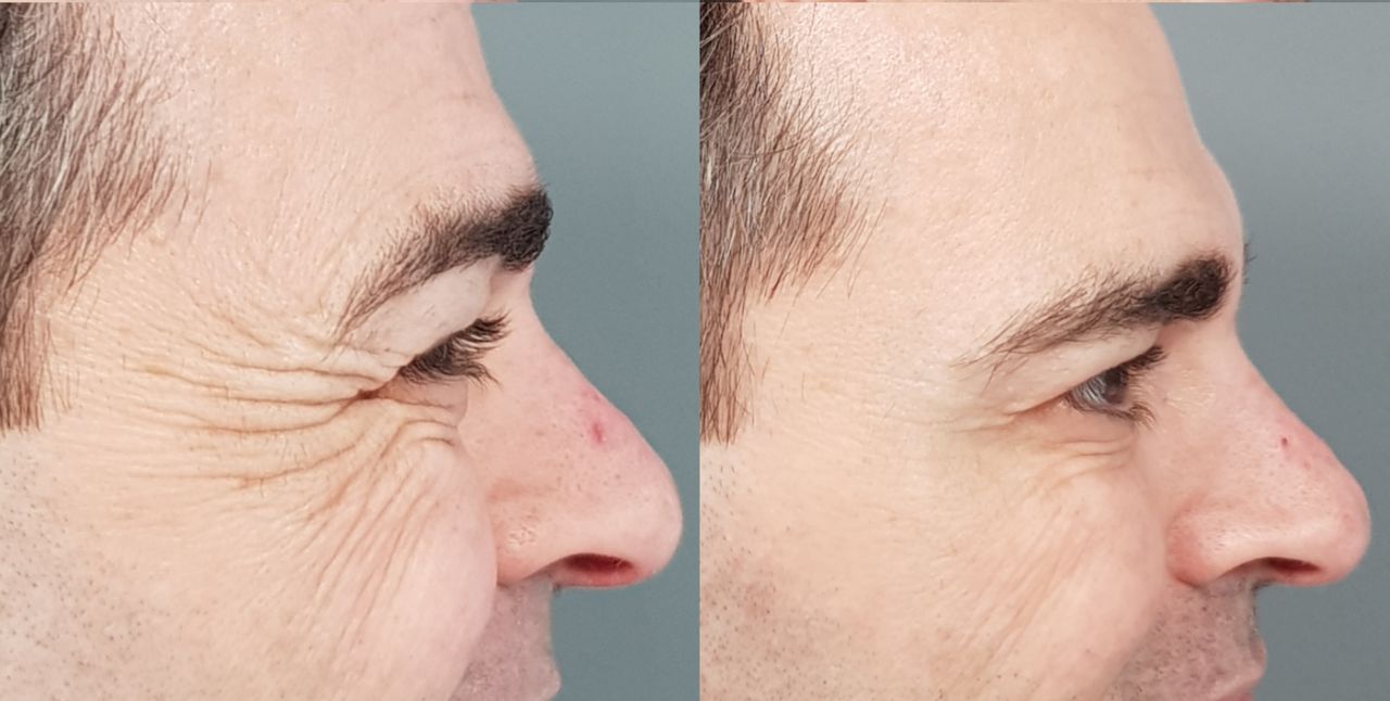 Rosalba Herrero Zerpa-156