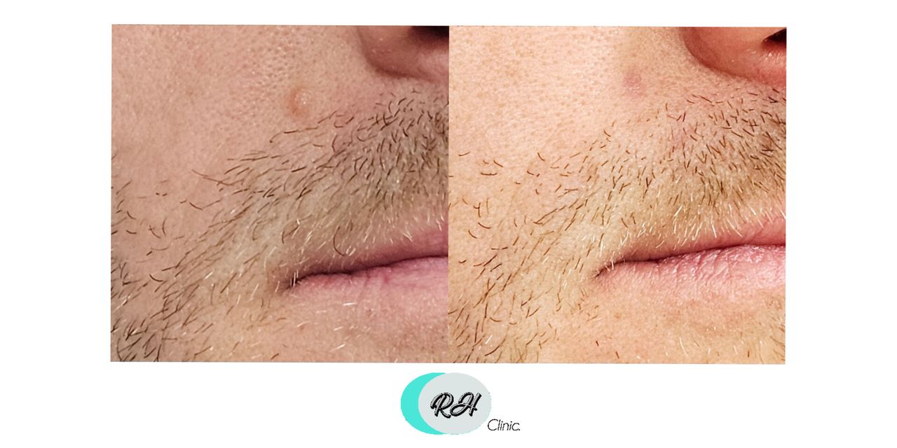 Rosalba Herrero Zerpa-621