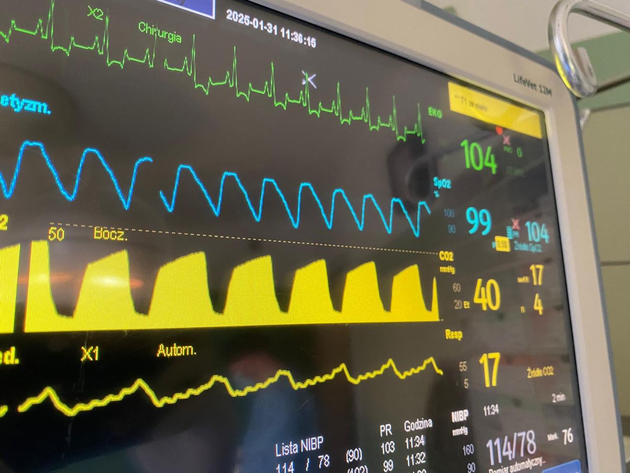 Radosław Fedaczyński-43