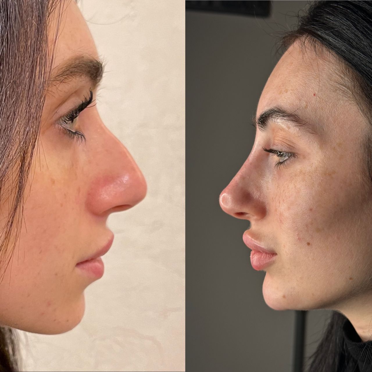 Alberto Di Bartolomeo-1