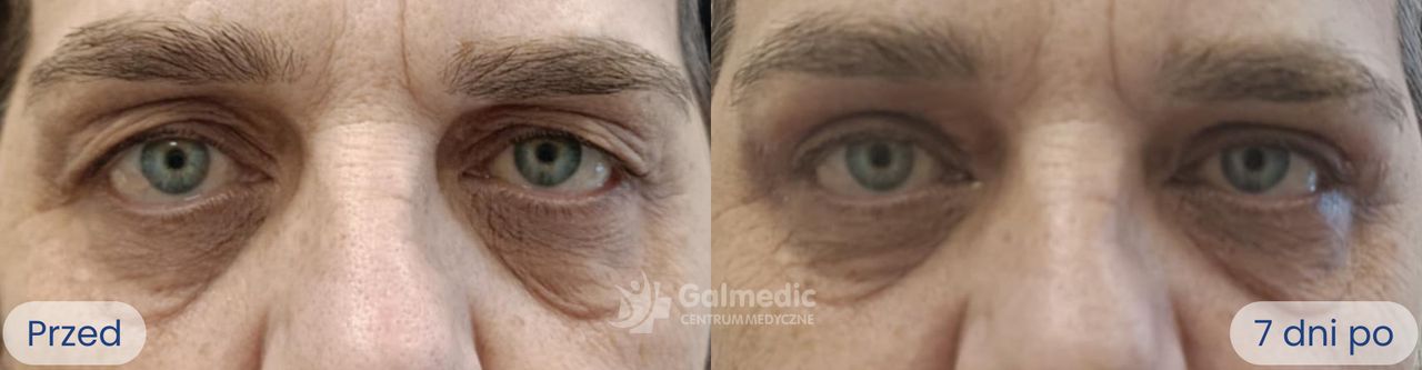 Aneta Michalik-Jakubek-0