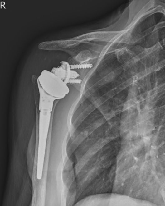 Gennaro Campopiano-5