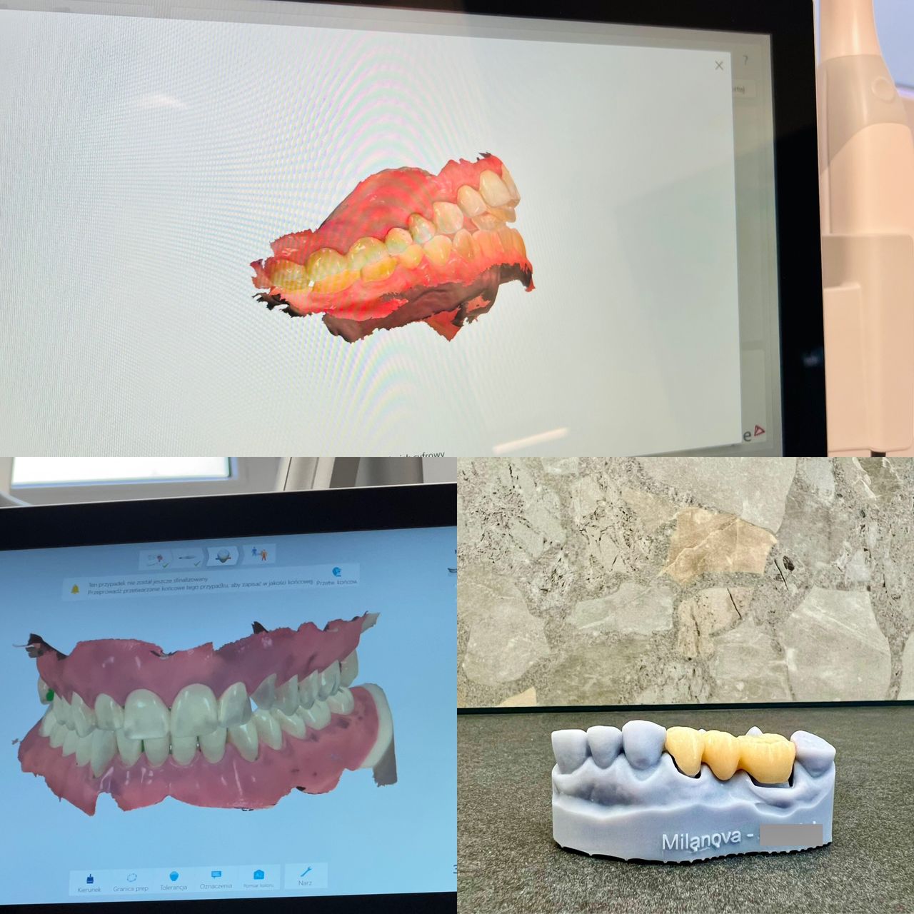 Yevhenii Burdeinyi-6