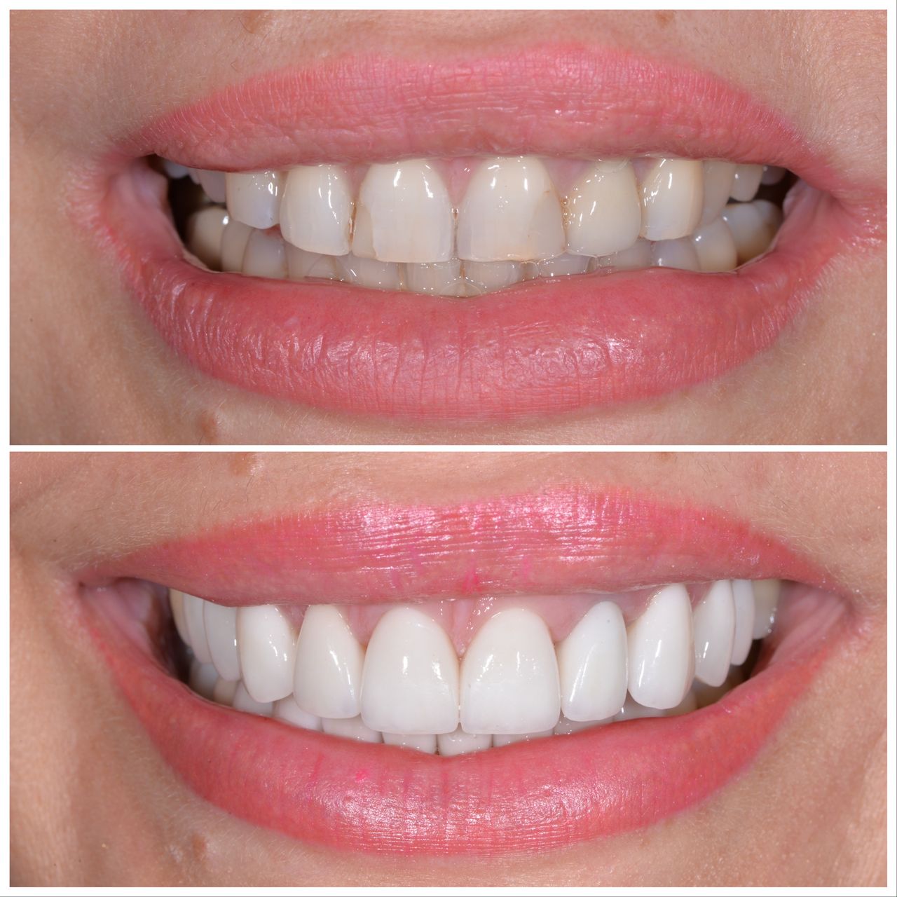 Martin Bartoszcze-35