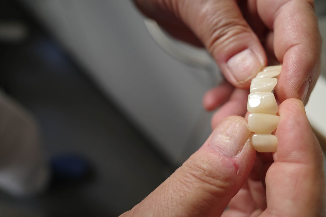 Gianluigi Bittante-90