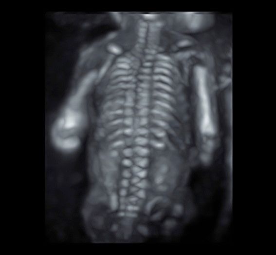 Tommaso Incandela-26