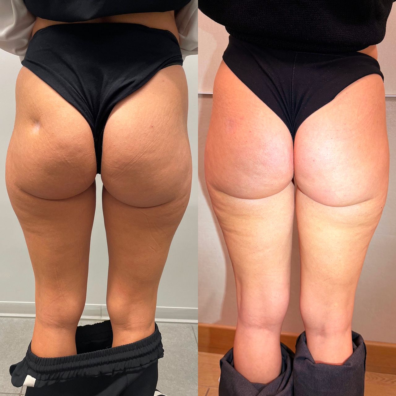 Marco Carmisciano-16