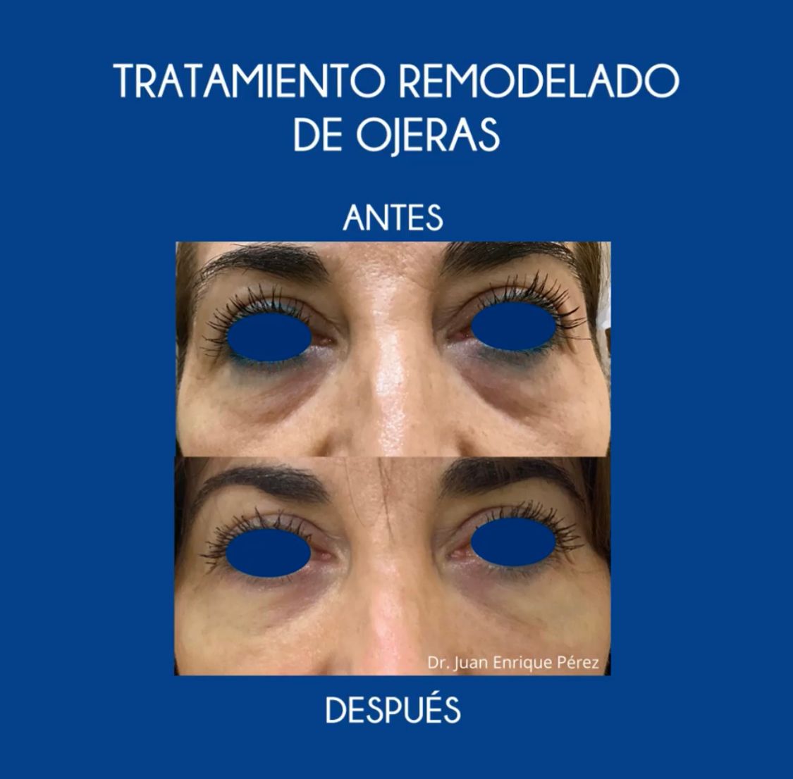 Juan Enrique Pérez Enríquez-63