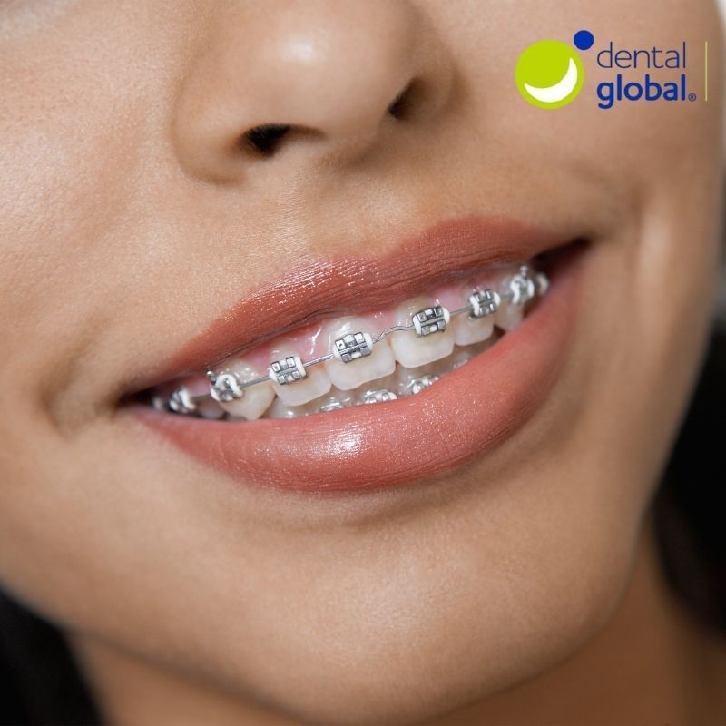 Rebeca Perez Garcia-8