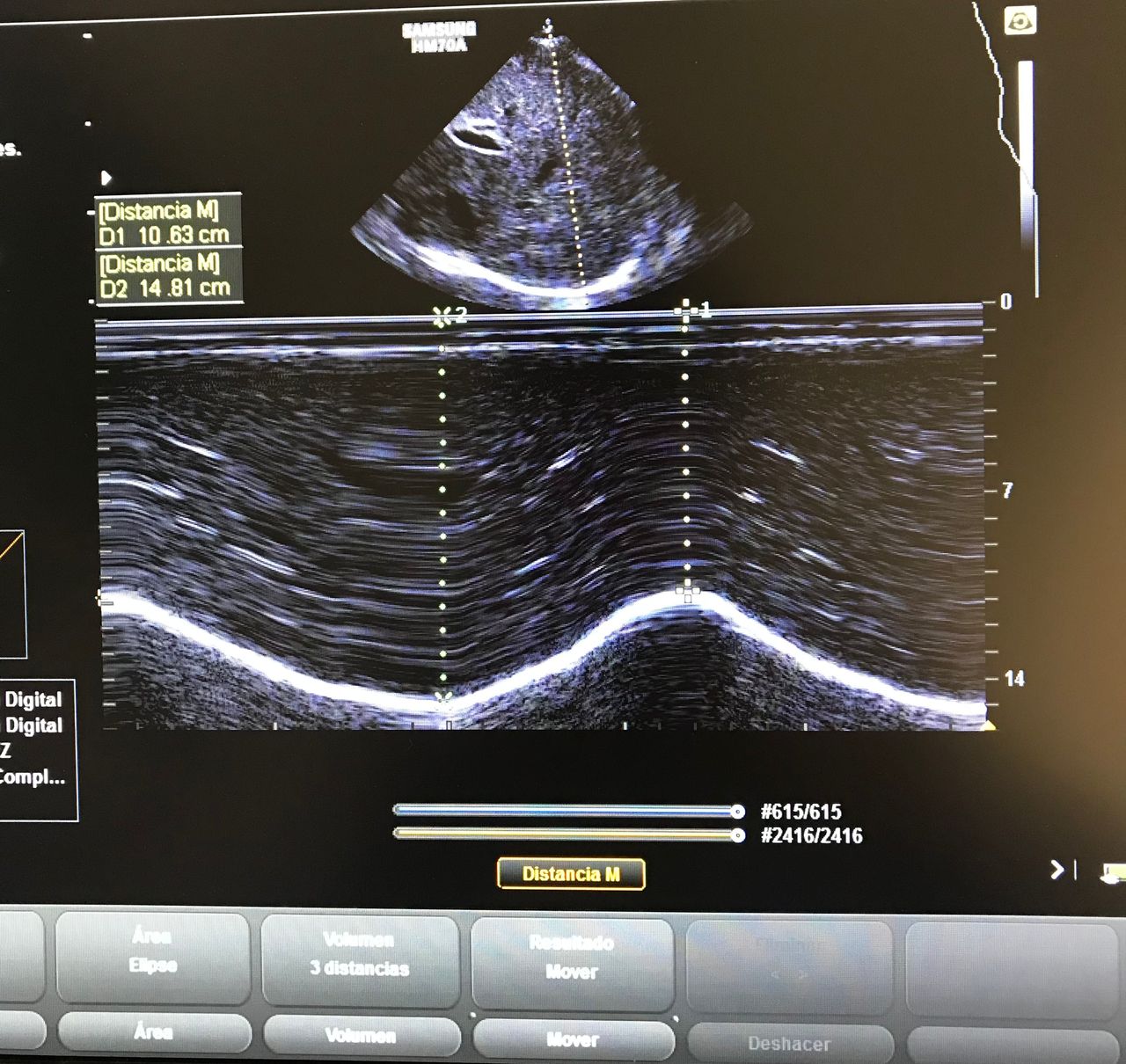 Ana Hernandez Voth-1