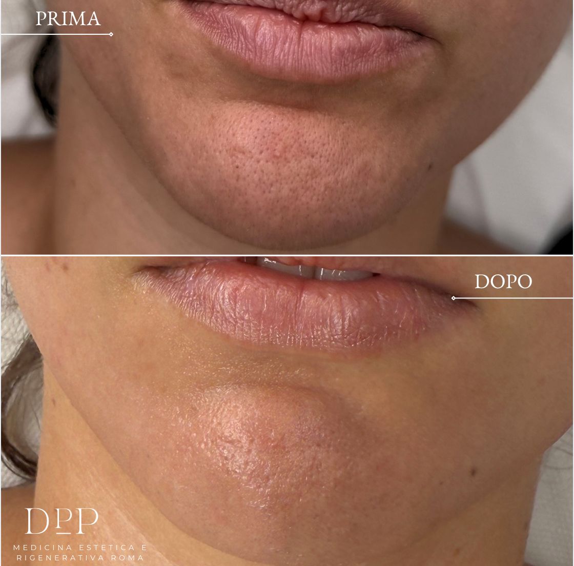 Davide Prosperi Porta-1