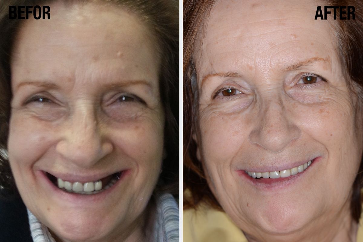 Alessandro Palumbo-30