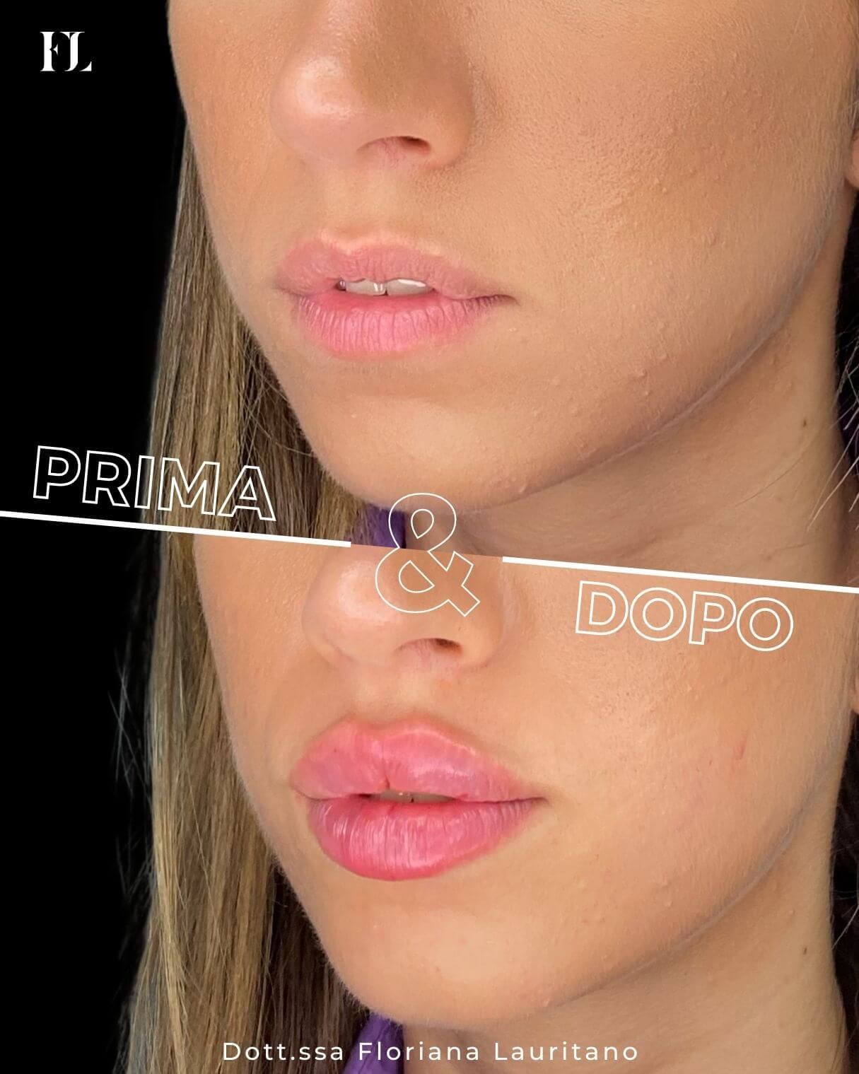 Floriana Lauritano-15