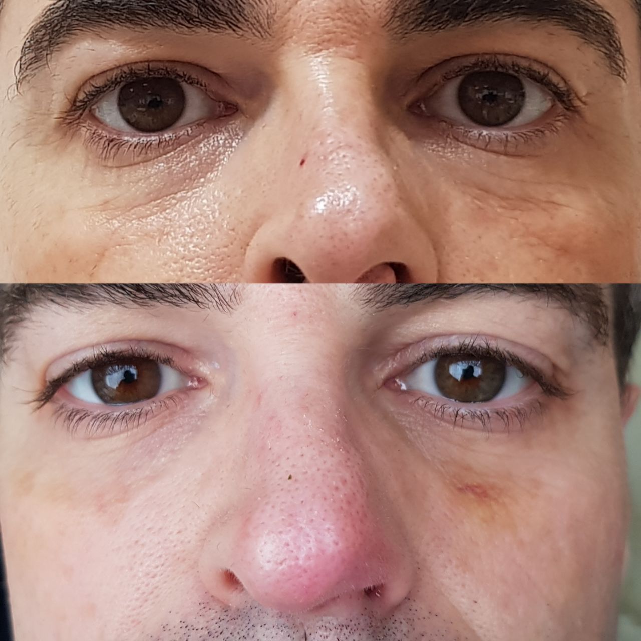 Rosalba Herrero Zerpa-284