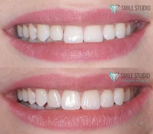 Michał Jankowski-17